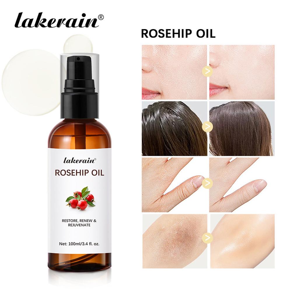 Rosehip Oil For Face & Skin Or - Cold Pressed Rose Hip ulasan dan harga