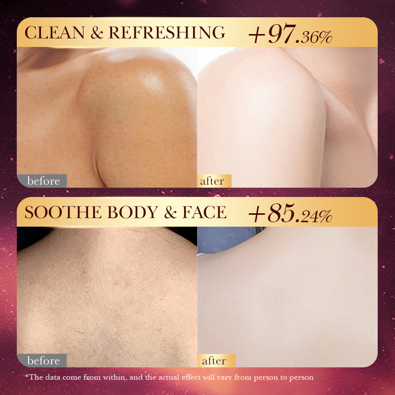 Rose Gold Foil Handmade Soap – - Luxury Skincare Gifts For Women ulasan dan harga