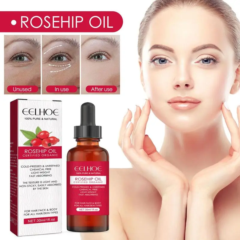 30ml Organic Rosehip Seed Oil  - Cold Pressed Rose Hip ulasan dan harga